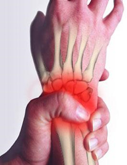 Wrist & Hand Injuries 3