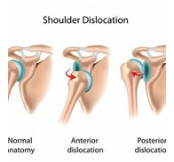 Shoulder Injuries 2